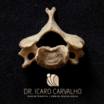 Tratamento das metástases ósseas na coluna vertebral